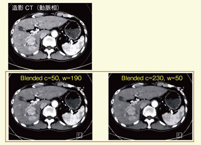 }11@composite imageFoptimum contrasẗ