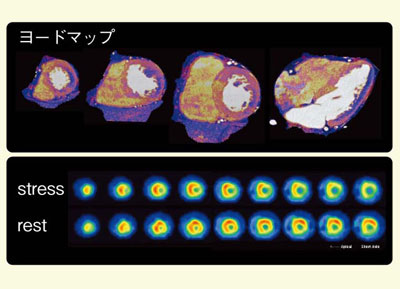 }1@Ǘ1F[h}bvƐSSPECTŋ̈悪v
