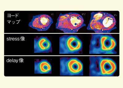 }3@Ǘ2F[h}bvƐSSPECT