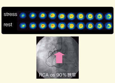 }4@Ǘ3FSSPECTł͋̕]ȏǗ