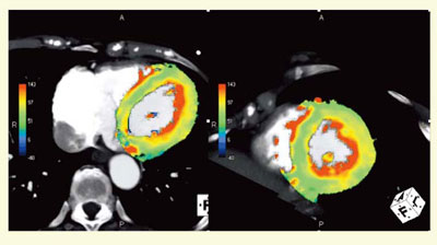 }6@Definition FlashpS،ʕ]