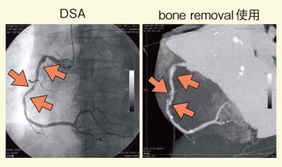 }7@DEC[WOɂΊDi64΁CEAP RCAΊDj