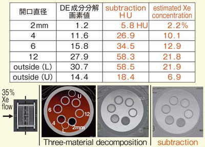 図5　Three-material decompositionとsubtractionの比較
