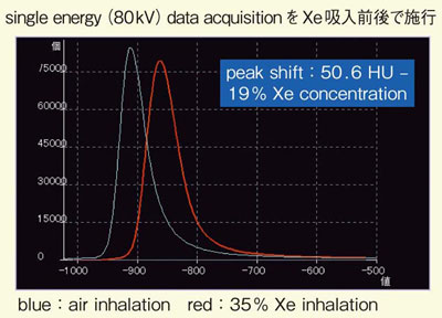 図8　症例1：空気呼吸時とXenon吸入時のCT値ヒストグラム