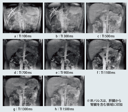 }1@NATIVE@TÏႢɂ錌ǑƔwiM̈ႢiTI100`1500msj