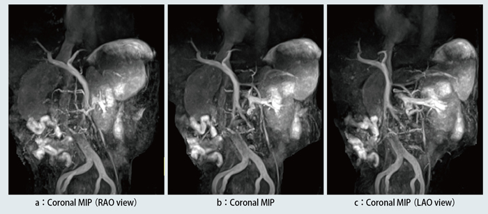 }7@ǗSF喬iǂɂ鑤sH̕`oiInferiorIR pulsej