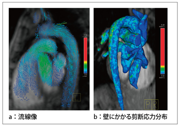 }1@4D Flowł̏o͉摜 zq̗iajCт̏񂩂ǂɂ陒f͕zibjvZĂB
