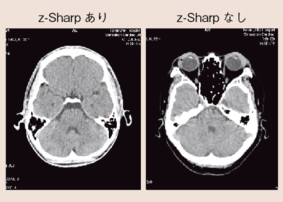 }4@z-Sharpɂ铪WindmillA[`t@Ng̗}