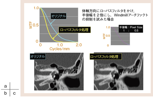 }6@[pXtB^ɂWindmillA[`t@Ng̗}