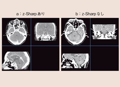 }9@ɂWindmillA[`t@Ng̉e