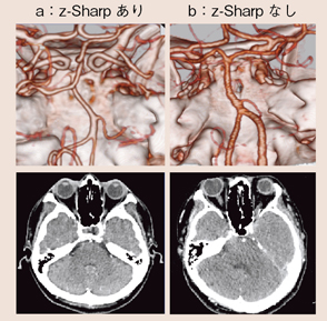 }10@CTAɂWindmillA[`t@Ng̉e