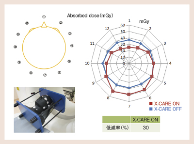 図7 頭部表面吸収線量