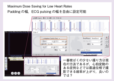 }5@New Adaptive Cardio Sequence