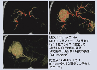 図1 多相造影CTによる4D Imagingの例