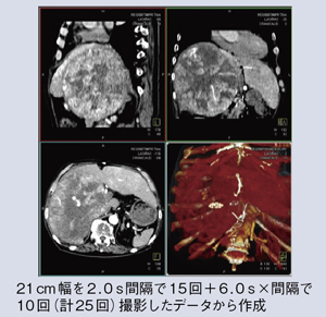 }2@Adaptive 4D Spiralɂ쐬4D摜