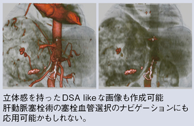 }3@Adaptive 4D Spiralɂ3D DSA likeȉ摜