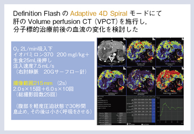 }6@VPCTɂᇌCT󗬉摜