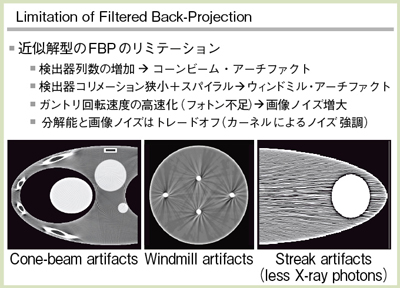 図1 FBPのリミテーション