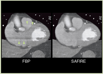 }7@ՏɂFBPSAFIRẼA[`t@Ng}ʂ̔r