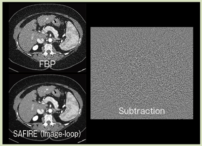 図8 FBPとSAFIREの画像ノイズ低減効果の比較