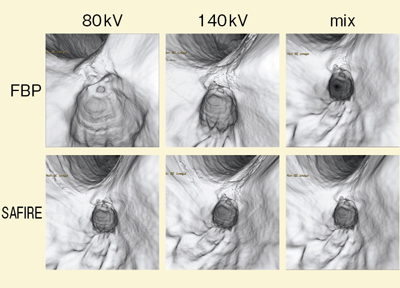 }1@Ǘ1Fcomposite image FBPSAFIRE̔r