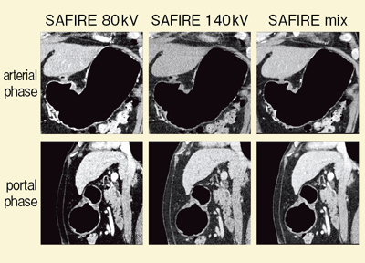 }2@Ǘ1F_Ci~bNCTiSAFIREgpj