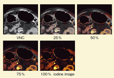 }3@Ǘ1FLiver VNCɂiodine/composite image