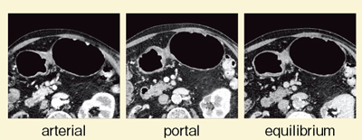 }4@Ǘ1FC喬Ctcomposite imageiSAFIREpj