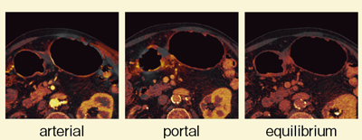 }5@Ǘ1FC喬Ct75iodine imageiSAFIREpj
