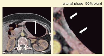 }6@Ǘ2F50%uhiodine image