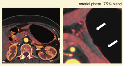 }7@Ǘ2F75%uhiodine image