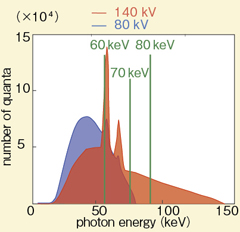 図1 Monoenergetic Imagingの原理 心臓領域は100kVpと140kVpで撮影