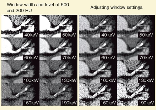 図2 Monoenergetic Imagingの肉眼的評価