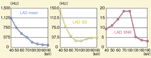 図3 Monoenergetic Imagingの客観的評価