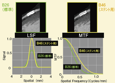 }2@č\֐̈Ⴂɂbone removal