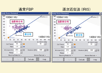 }5@DEC[WOTwo-material decompositionł̔r