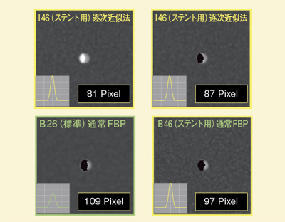 図7 コンピュータシミュレーションによるIRISとFBP法の比較