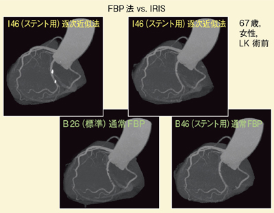 }8@Ǘ1FIRISɂΊDǗ xpOiangio viewj