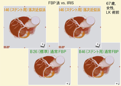 }9@Ǘ1FIRISɂΊDǗ xpOiVRj