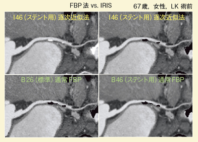 }10@Ǘ1FIRISɂΊDǗ xpOiCPRj