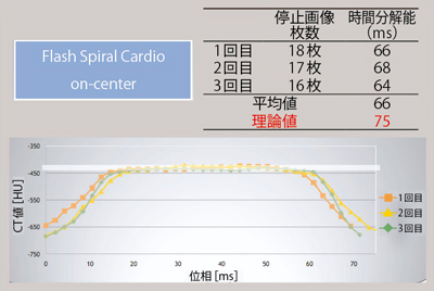 }3@Flash Spiral Cardioion-centerj