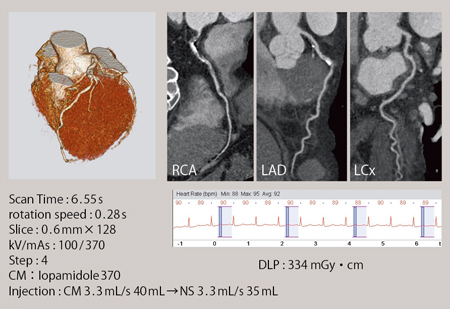 }6@Flash Cardio Sequenceɂ銥CTiHigh HRj