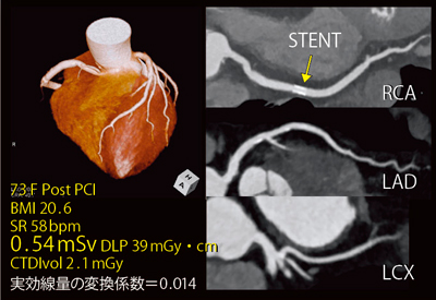 }3@Ǘ1FPCItH[AbviFlash Spiral Cardioj