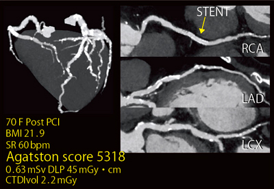 }4@Ǘ2FxΊDǗiFlash Spiral Cardioj