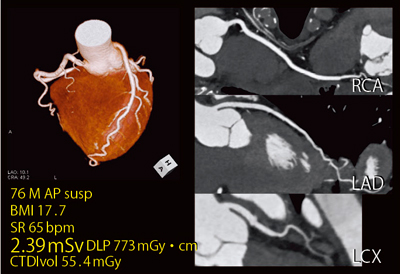 }5@Ǘ3FSǋ^iFlash Cardio Sequencej