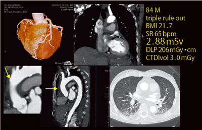 }7@Ǘ5Fǌ^s哮𗣁iFlash Chest Painj