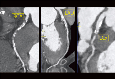 }2@Ǘ1Fcurved MPR摜