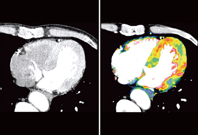 }7@4D Displayperfusion mapiǗ2j