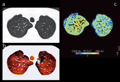 }2@Ǘ1FxCCGOLDUixj aFPCTCbFXeC[W cFparenchyma摜