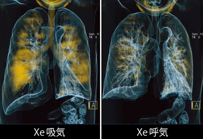 }4@Ǘ1FxCCGOLDUiXeC[Wj